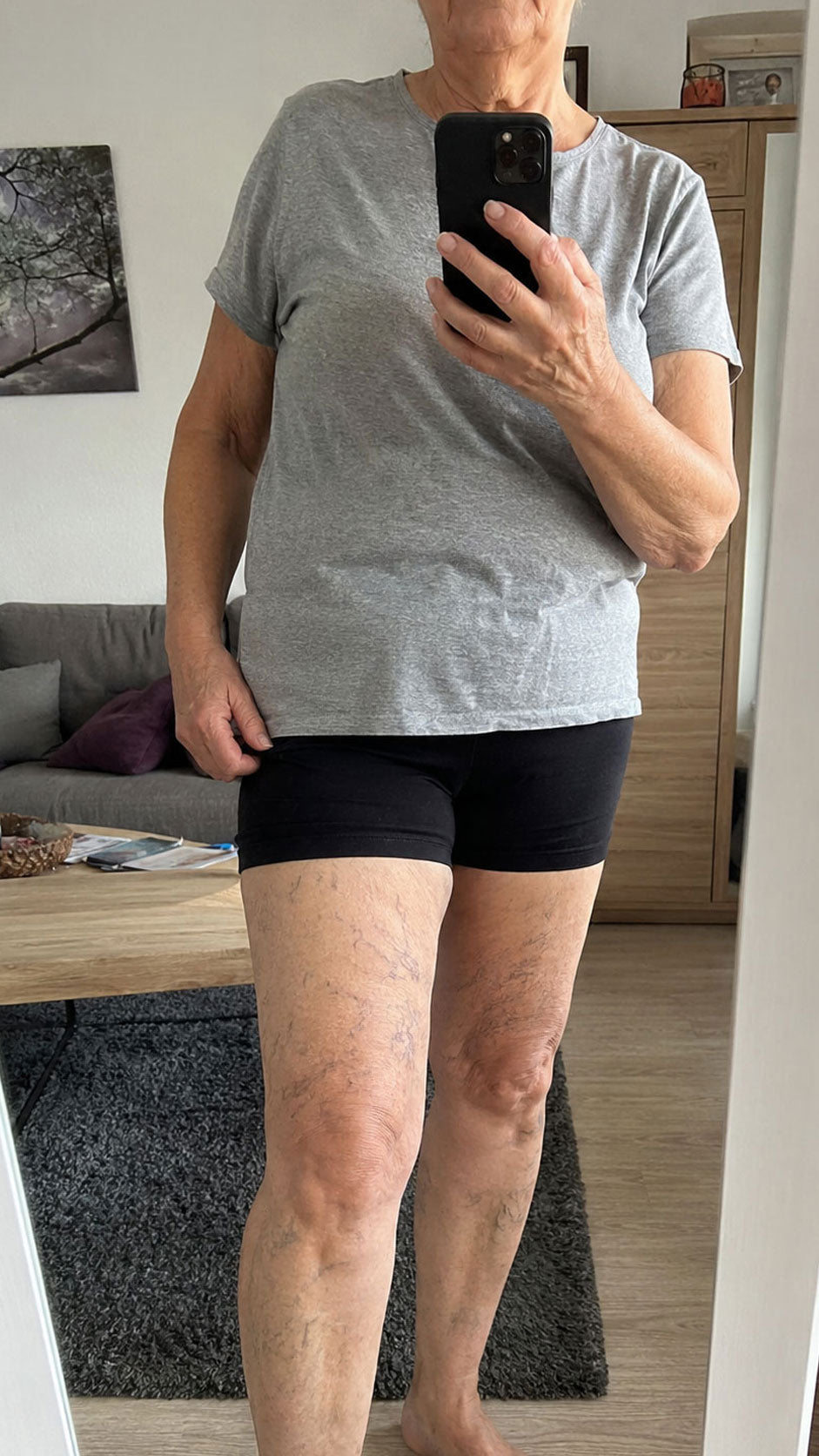 Vorher
