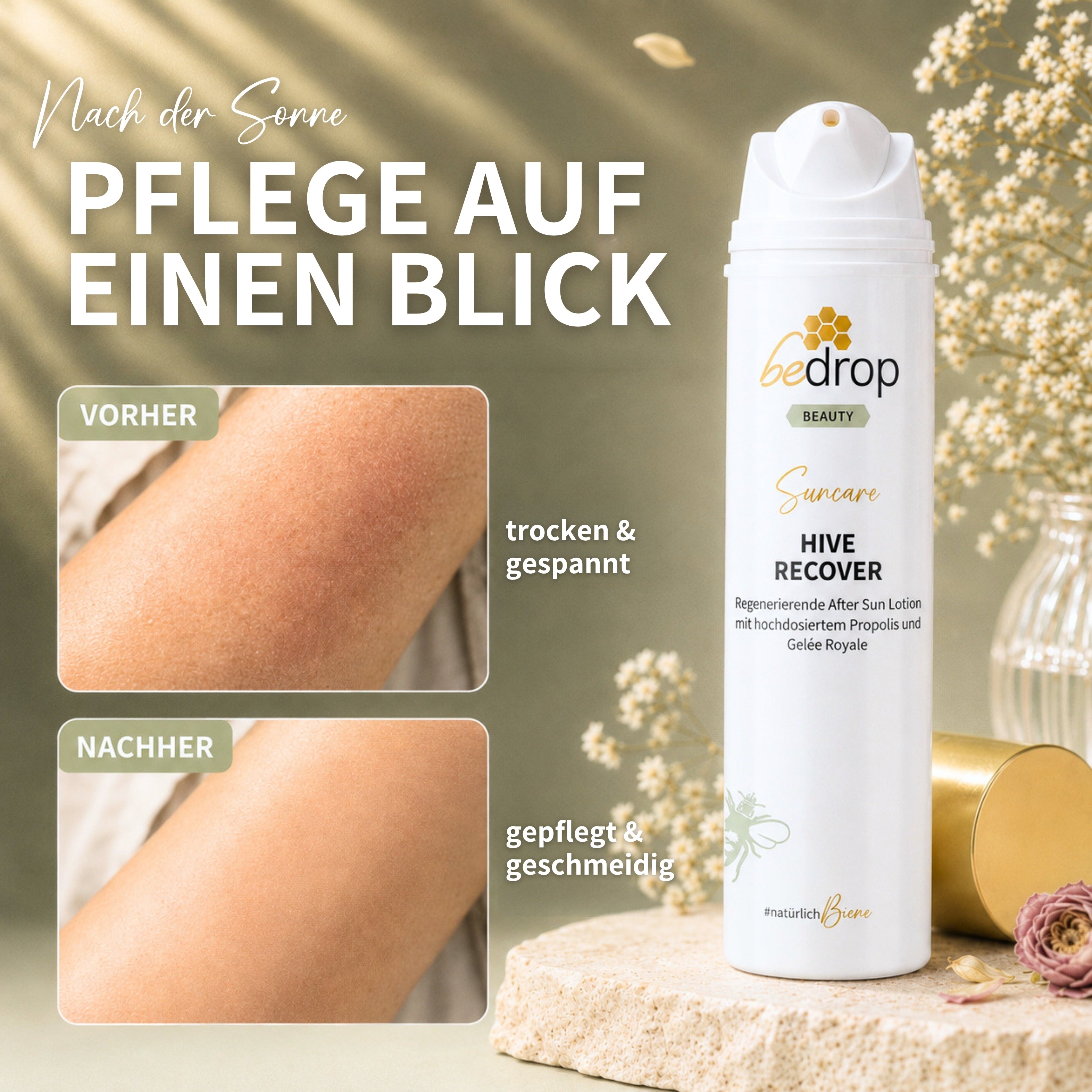 HIVE RECOVER - regenerierende After Sun Lotion mit hochdosiertem Gelée Royale & Propolis - 200ml